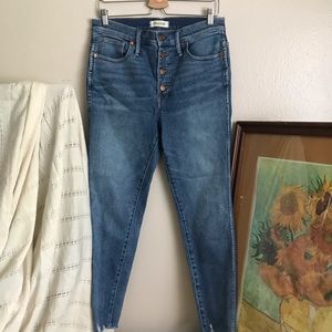 Madewell Button Fly high rise raw hem jeans